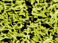 Биологи выяснили, почему бактерии Clostridium difficile так опасны - «Новости Медицины»
