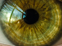 Диагностировать отклонение в работе сердца помогут глаза человека - «Новости Медицины»
