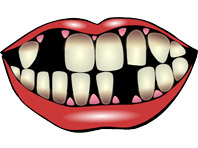 Диеты, веганство и алкоголь разрушают зубы, предупреждают эксперты - «Новости Медицины»