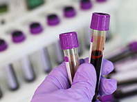 Группа крови покажет личный риск онкологических заболеваний - «Новости Медицины»