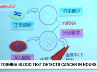 Японцы научились диагностировать рак всего за пару часов - «Новости Медицины»