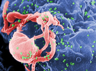 Эпидемиологи рассказали, как ведет себя ВИЧ во всем мире - «Новости Медицины»