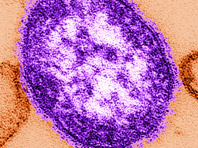 Корь вызывает "иммунную амнезию", предупреждают инфекционисты - «Новости Медицины»
