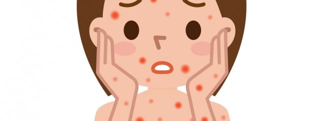 Краснуха – детская инфекция с недетскими последствиями - «Гинекология»
