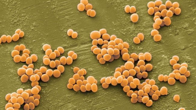 Нашли новое лекарство для борьбы с супербактериями - «Дерматология»