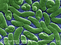 Мировые курорты может захватить бактерия Vibrio vulnificus - «Новости Медицины»
