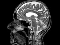 Неврологи исследовали мозг боксеров и бойцов смешанных единоборств - «Новости Медицины»