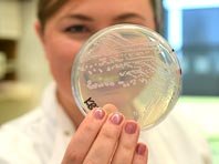 Новое открытие объясняет, как бактериям удается избежать атаки лекарств - «Новости Медицины»