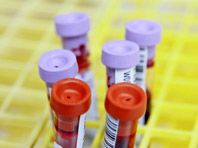 Новый анализ крови переворачивает диагностику онкологических заболеваний - «Новости Медицины»