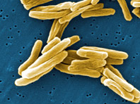 Отечественные химики подошли ближе к избавлению от туберкулеза - «Новости Медицины»