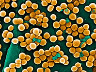 Открытие: аллергия, болезнь кожи и особые бактерии связаны - «Новости Медицины»
