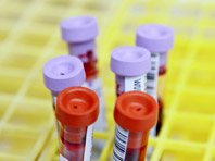 Врачи предлагают по-новому трактовать анализы крови - «Новости Медицины»
