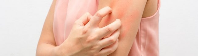Дупилумаб одобрен Минздравом для лечения атопического дерматита у подростков - «Аллергология»