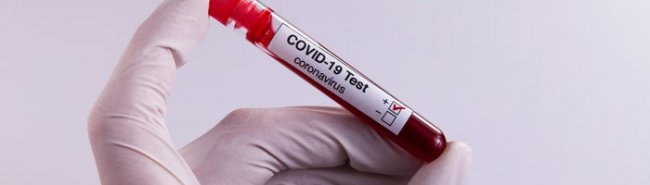 Хеликс начнет выполнять анализ на коронавирус COVID-19 - «Гастроэнтерология»
