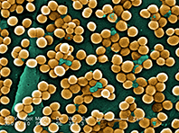 Биологи нашли слабое место у супербактерии золотистого стафилококка - «Новости Медицины»