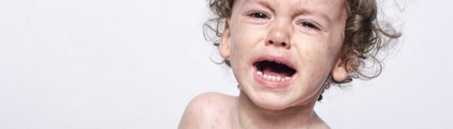 Из-за пандемии COVID-19 более 117 млн детей пропустят вакцинацию против кори - «Гинекология»