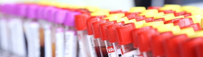 В РФ к диагностике коронавируса подключились 250 лабораторий - «Новости Медицины»