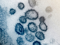 Ученые решили проблему цитокинового шторма у жертв коронавируса - «Новости Медицины»