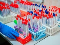 В России будет широко доступно тестирование на коронавирус - «Новости Медицины»
