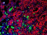 Обнаружена новая мишень для терапии самых агрессивных опухолей - «Новости Медицины»