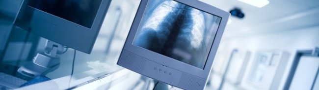 Минздрав утвердил новые правила проведения рентгенологических исследований - «Инфекционные заболевания»