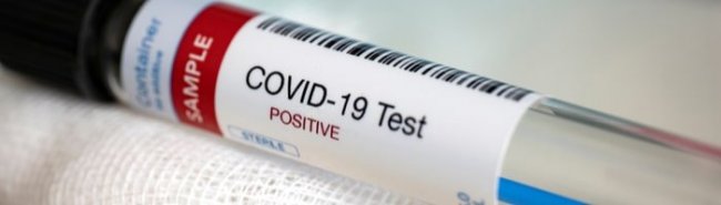 Тест-система «Система-БиоТех» позволит выявить коронавирус за 15 минут - «Гинекология»