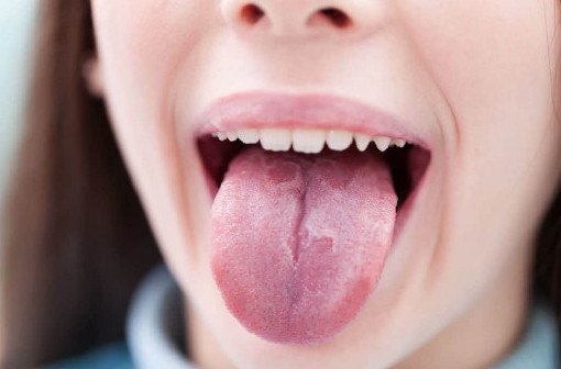 По каким изменениям в полости рта можно выявить рак - «Онкология»