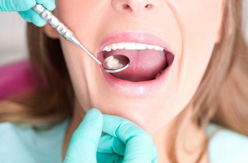 Что делать, если болит зуб - «Стоматология»