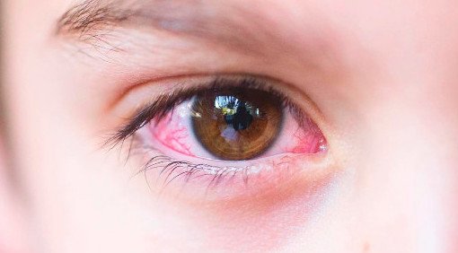 Пресбиопия: «климакс» глаз у мужчин и женщин - «Новости Медицины»