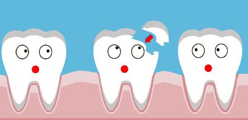 Daily Express: пять простых шагов для защиты зубов от кариеса - «Стоматология»