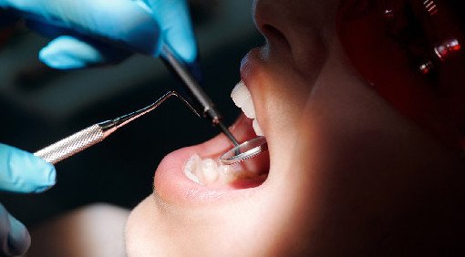 Стоматолог Кадькалова предупредила о зубной боли, которую перетерпеть не получится - «Стоматология»
