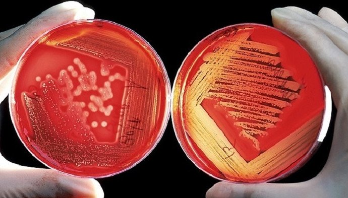 Сколько бактерий в нашем кишечнике? - «Новости Медицины»