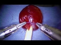 Робот-хирург виртуозно зашивает треснувшую виноградину - «Хирургия»