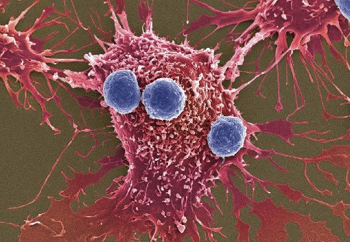 Ученые создают вирус, который может уничтожить опухолевые клетки - «Онкология»